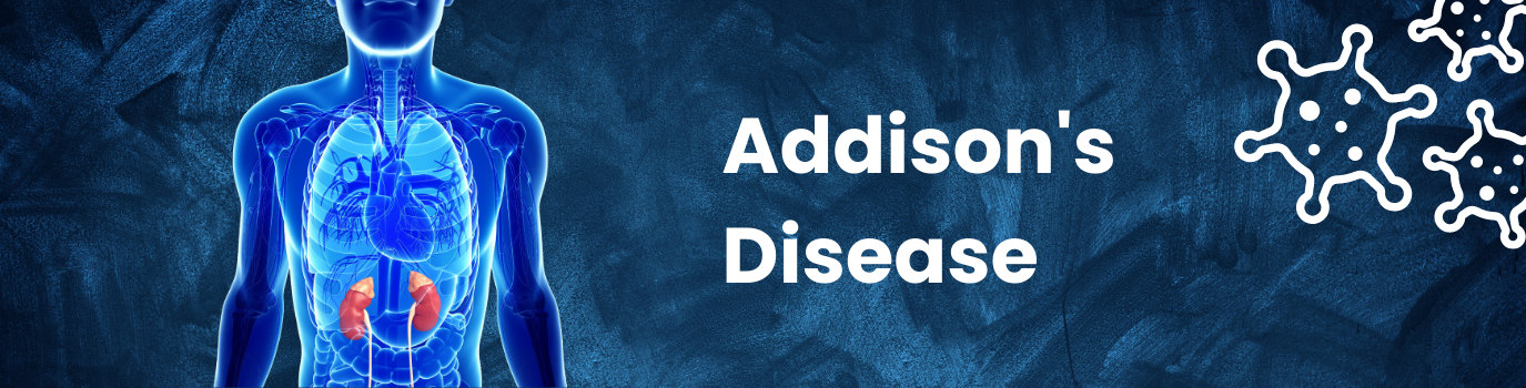 Addisons_Disease16732498