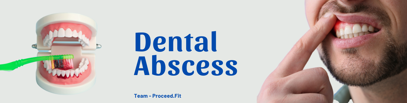 Dental_abscess16732498