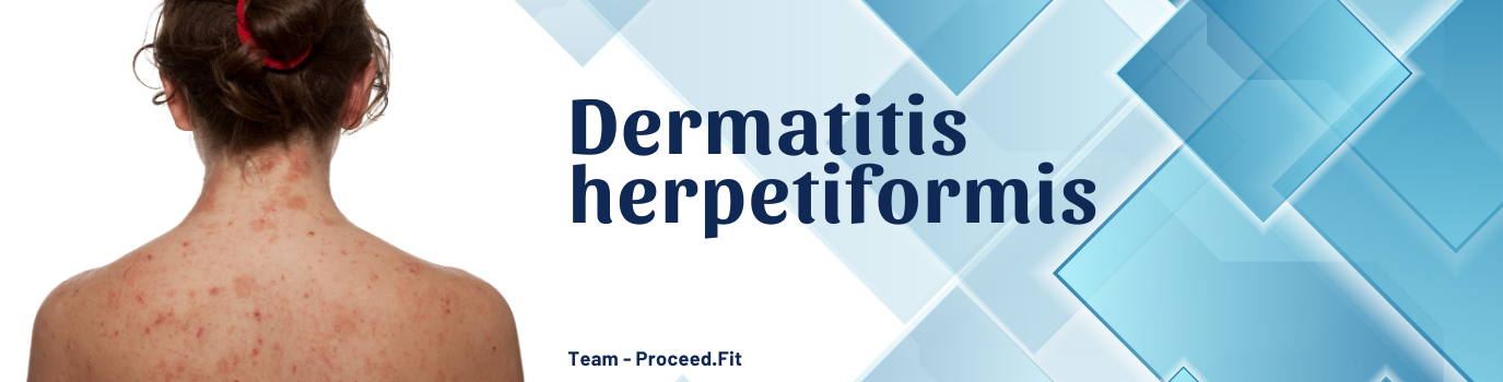 Dermatitis_herpetiformis16732498