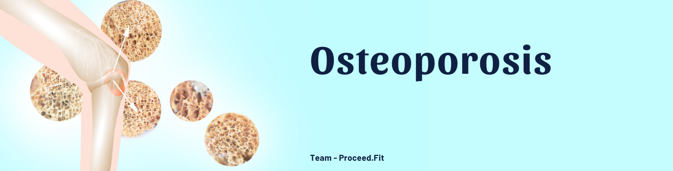 Osteoporosis16732498